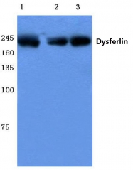 AP06090PU-N - Dysferlin
