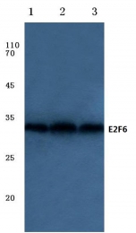 AP06092PU-N - E2F6