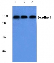AP06093PU-N - CD324 / Cadherin-1