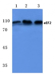 AP06094PU-N - EEF2