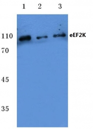 AP06095PU-N - EEF-2 kinase