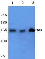 AP06098PU-N - EGFR / ERBB1