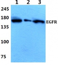AP06099PU-N - EGFR / ERBB1