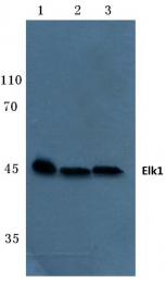 AP06101PU-N - ELK1