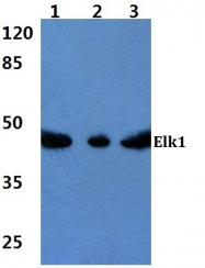 AP06102PU-N - ELK1