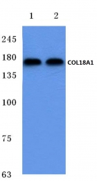 AP06103PU-N - Collagen type XVIII alpha 1 chain