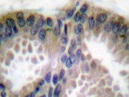 AP06103PU-N - Collagen type XVIII alpha 1 chain