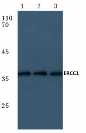 AP06106PU-N - ERCC1