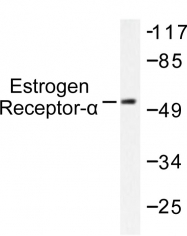 AP06109PU-N - Estrogen receptor alpha