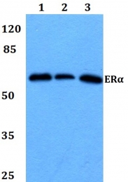 AP06110PU-N - Estrogen receptor alpha