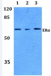 AP06111PU-N - Estrogen receptor alpha