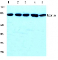 AP06113PU-N - Ezrin