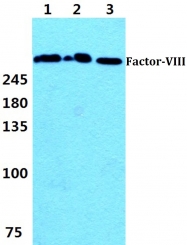 AP06114PU-N - Coagulation factor VIII (F8)