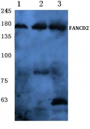 AP06115PU-N - FANCD2