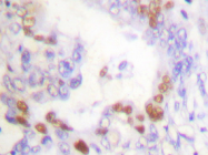 AP06115PU-N - FANCD2