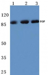 AP06118PU-N - FGFR1OP