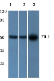 AP06124PU-N - FLI1