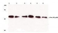 AP06125PU-N - c-fos