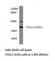 AP06126PU-N - Fos-related antigen 2
