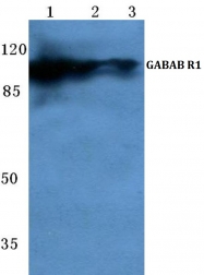 AP06128PU-N - GABBR1
