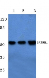 AP06129PU-N - GABRB1