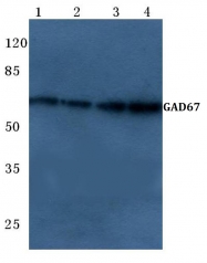 AP06130PU-N - GAD1 / GAD67