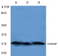 AP06131PU-N - GADD153 / CHOP