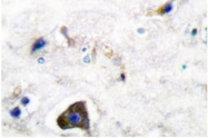 AP06136PU-N - GFRA1 / GDNFR-alpha