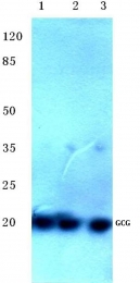 AP06137PU-N - Glucagon