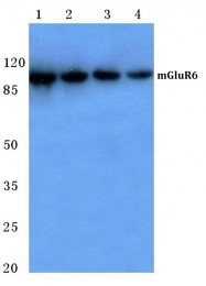 AP06141PU-N - Glutamate receptor 6 / GLUR6