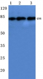AP06146PU-N - Glycogen Synthase