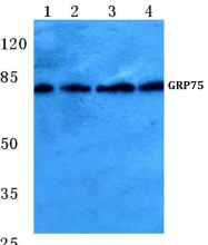 AP06148PU-N - Grp75 / HSPA9