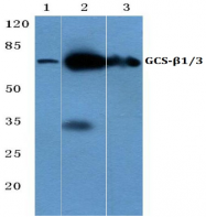 AP06153PU-N - Guanylate cyclase soluble GUCY1B3