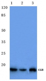 AP06154PU-N - Chorionic Gonadotropin (hCG)
