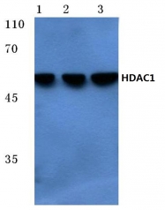 AP06155PU-N - HDAC1