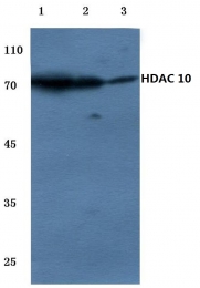 AP06156PU-N - HDAC10
