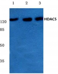 AP06158PU-N - HDAC5