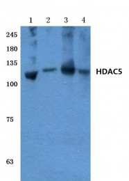 AP06159PU-N - HDAC5