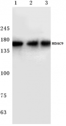 AP06163PU-N - HDAC9