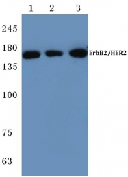 AP06165PU-N - CD340 / ERBB2 / HER2