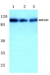 AP06171PU-N - Heat shock protein 105 / HSP105