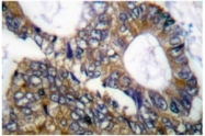 AP06171PU-N - Heat shock protein 105 / HSP105