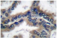 AP06173PU-N - DNAJB1 / HSP40