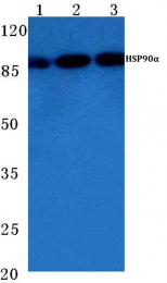 AP06175PU-N - HSP90AA1 / HSP90 alpha