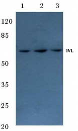 AP06184PU-N - Involucrin / IVL