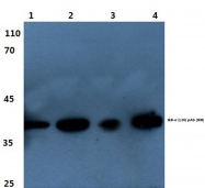 AP06185PU-N - NFKBIA / IKBA