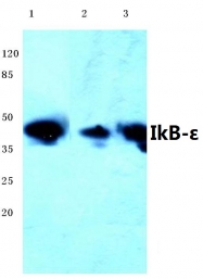 AP06186PU-N - NFKBIE / IKBE