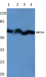 AP06194PU-N - Cytokeratin 10