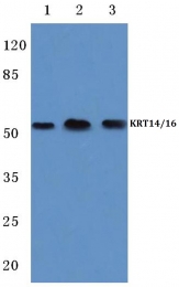 AP06195PU-N - Cytokeratin 14