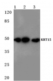 AP06196PU-N - Cytokeratin 15